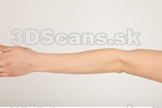 Photo reference of forearm 0001